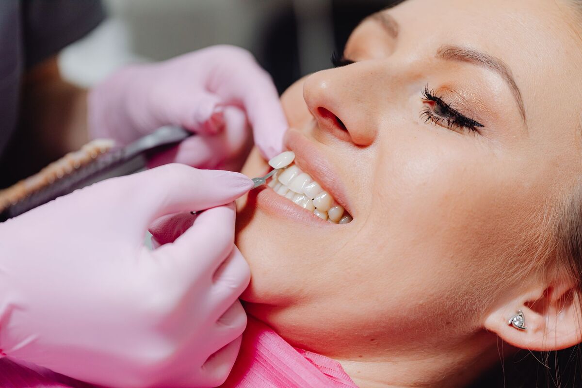 Cosmetic dentistry veneer shade matching in Nashville